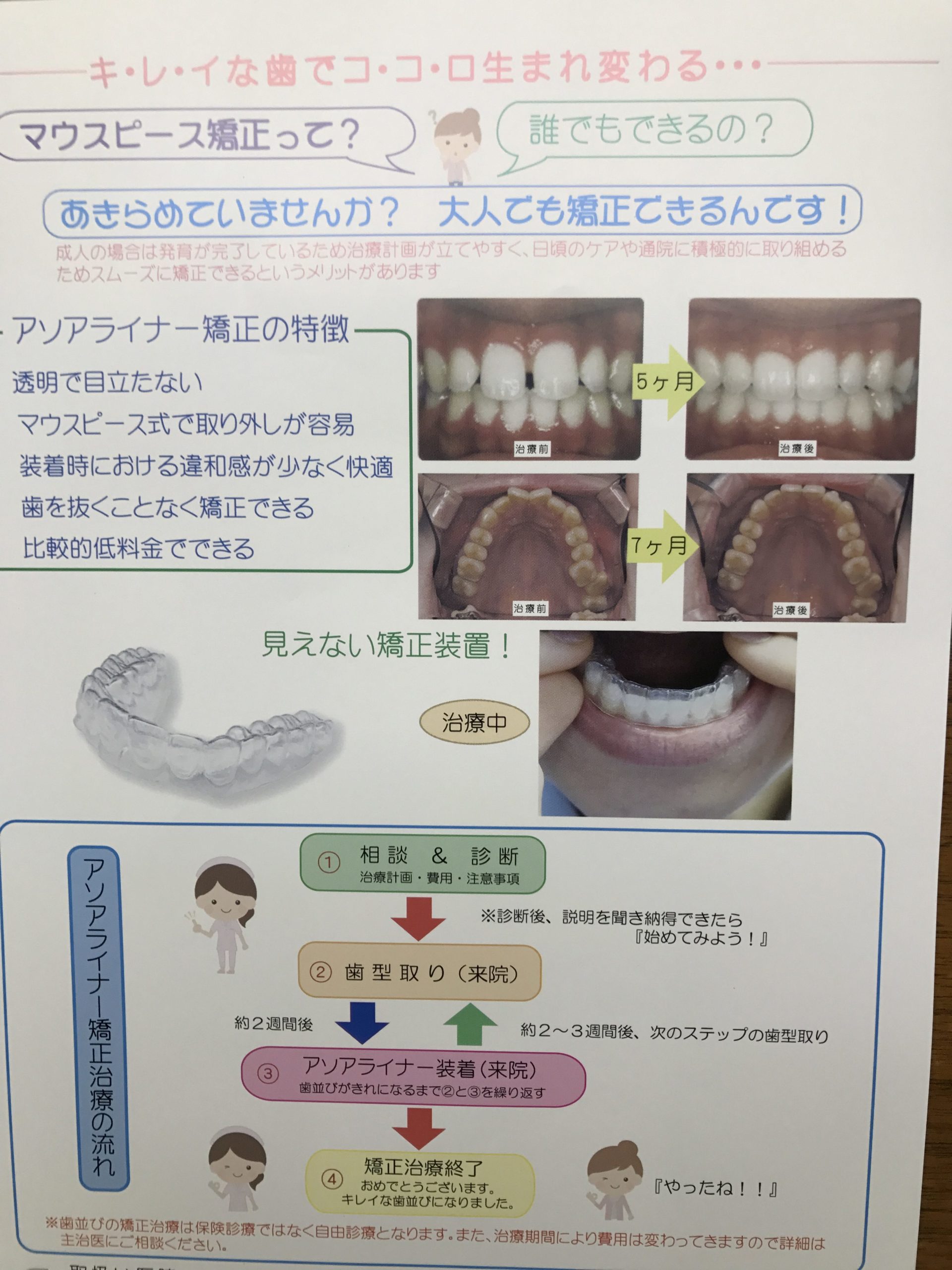 歯並び