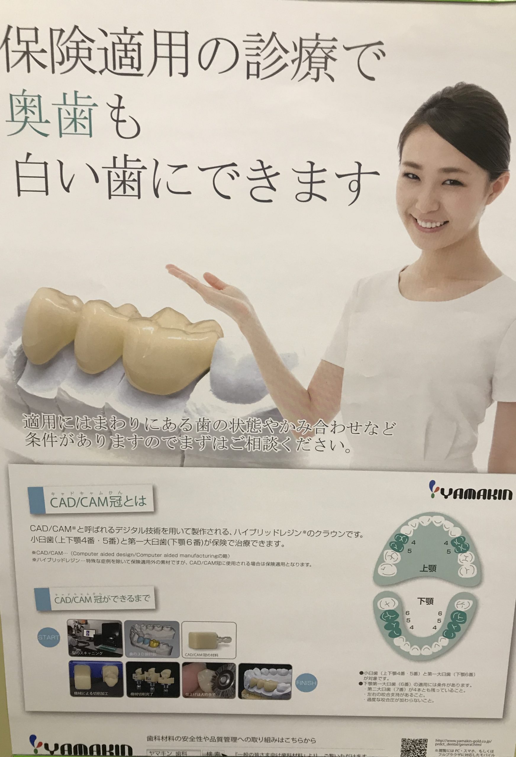 白い歯