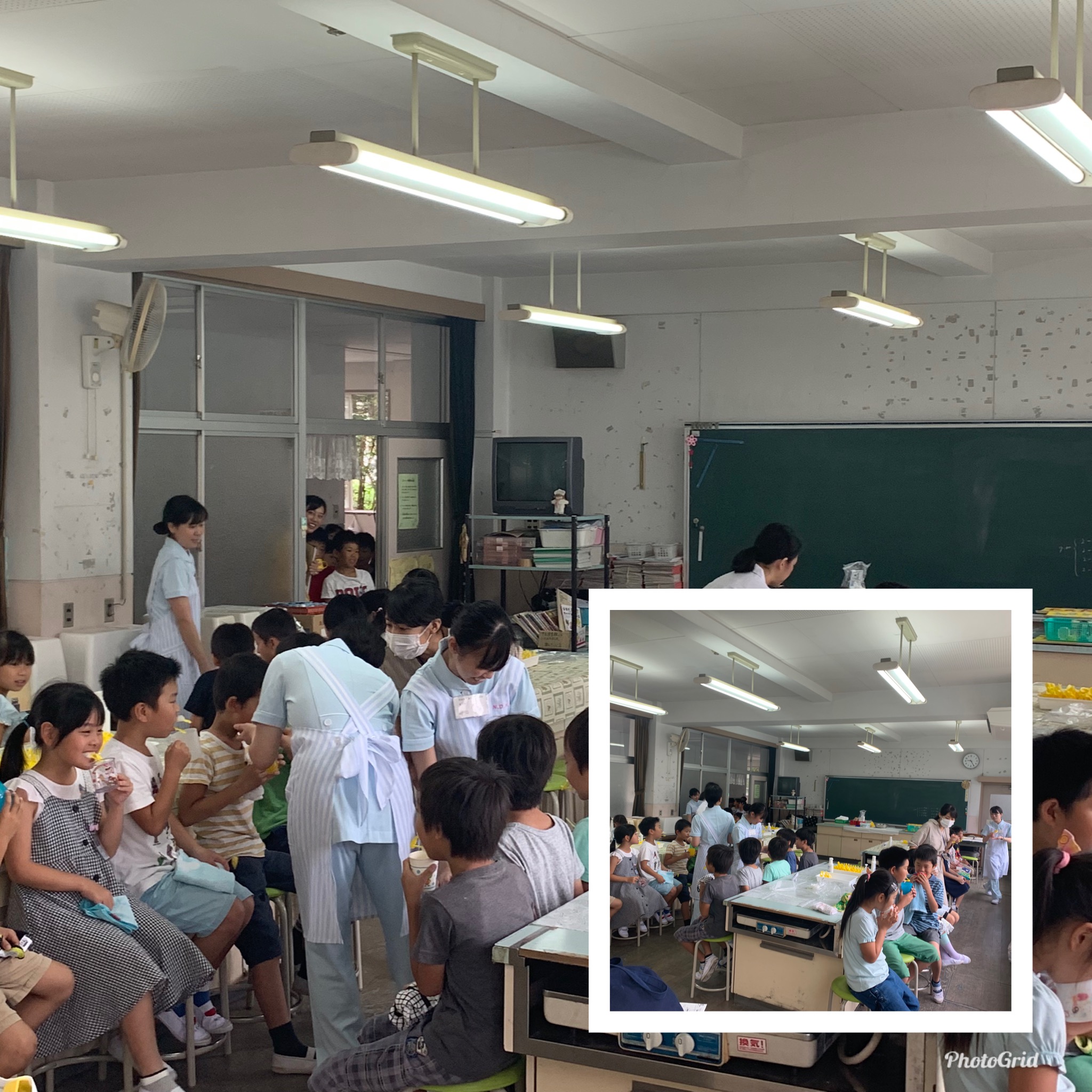 フッ素塗布