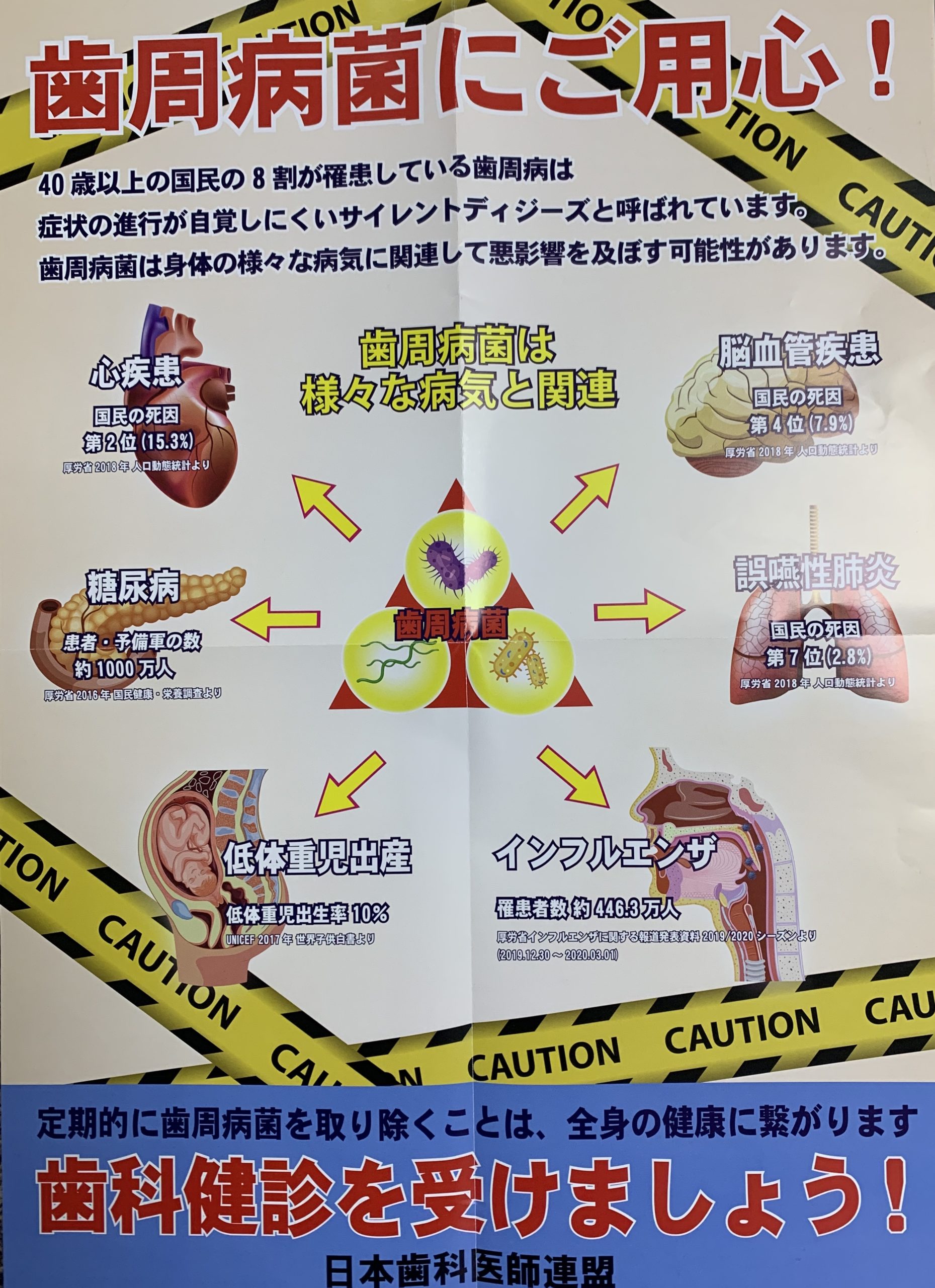 歯周病菌に注意