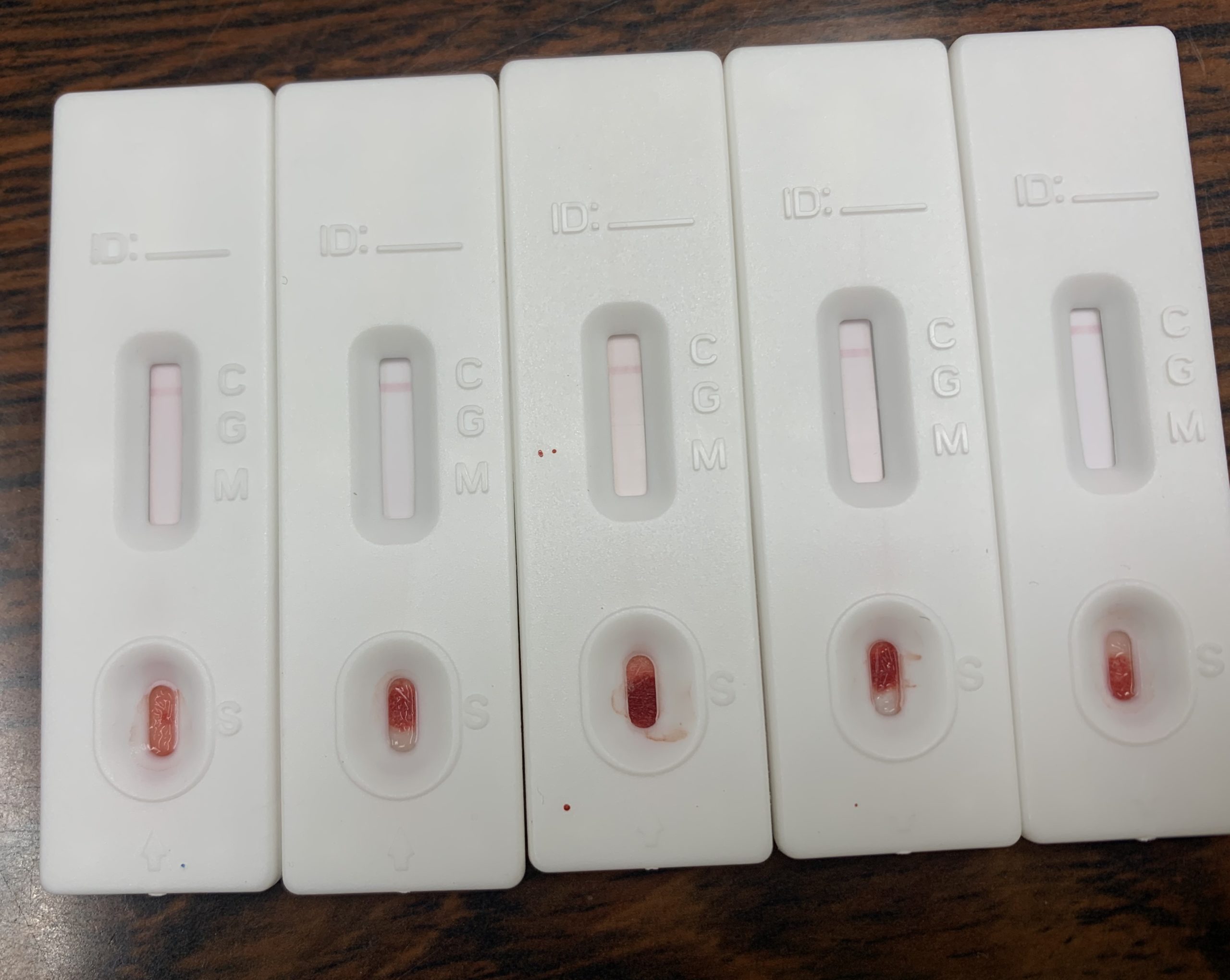 新型コロナ抗体検査